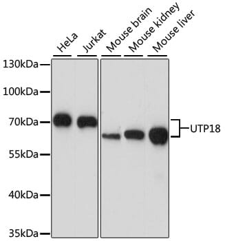 Western blot analysis of extracts of various cell lines, using Anti-UTP18 Antibody (A15441) at 1:1,000 dilution.
Secondary antibody: Goat Anti-Rabbit IgG (H+L) (HRP) (AS014) at 1:10,000 dilution.
Lysates / proteins: 25µg per lane.
Blocking buffer: 3% non-fat dry milk in TBST.
Detection: ECL Basic Kit (RM00020).
Exposure time: 30s.