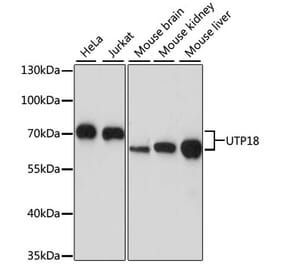 Western Blot - Anti-UTP18 Antibody (A87671) - Antibodies.com