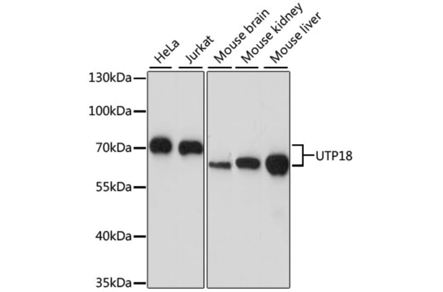 Western Blot - Anti-UTP18 Antibody (A87671) - Antibodies.com
