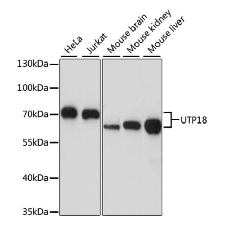 Western Blot - Anti-UTP18 Antibody (A87671) - Antibodies.com