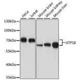 Western Blot - Anti-UTP18 Antibody (A87671) - Antibodies.com