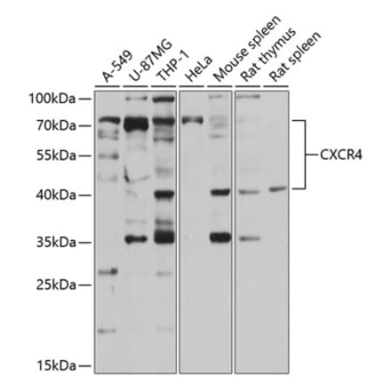 Western Blot - Anti-CXCR4 Antibody (A87672) - Antibodies.com