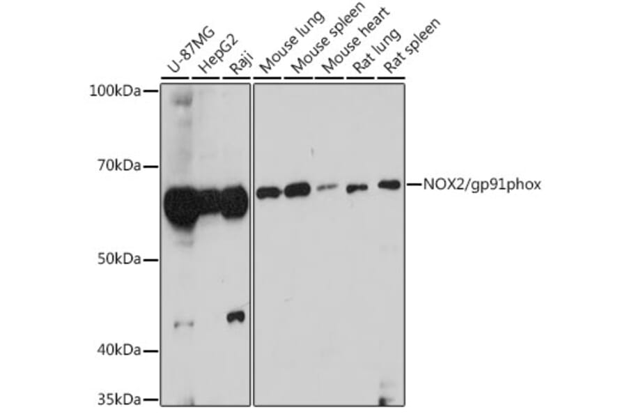 Western Blot - Anti-NOX2/gp91phox Antibody (A87673) - Antibodies.com