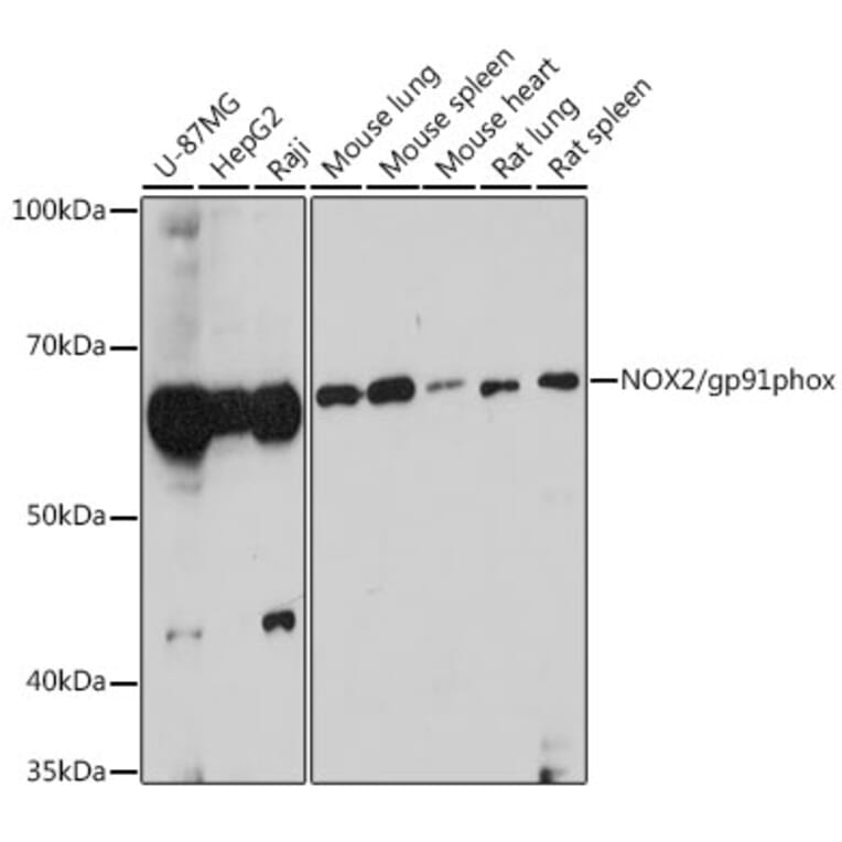 Western Blot - Anti-NOX2/gp91phox Antibody (A87673) - Antibodies.com
