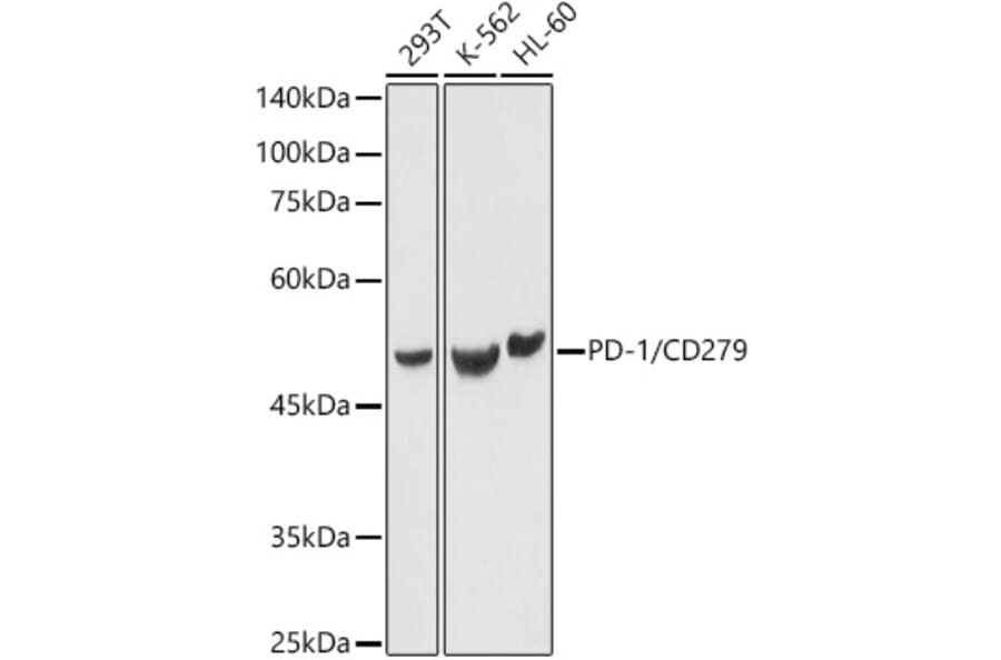 Western Blot - Anti-PD1 Antibody (A87674) - Antibodies.com