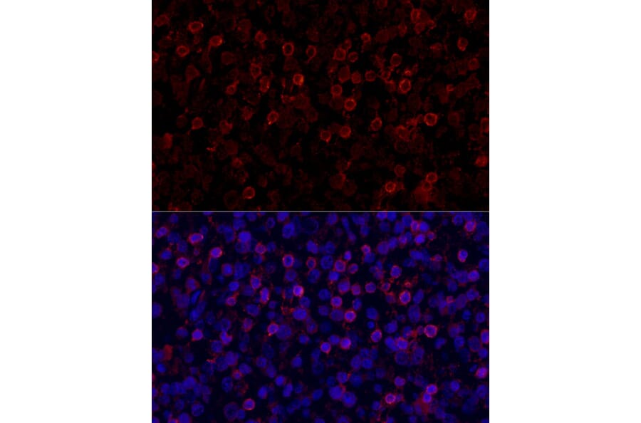 Immunofluorescence - Anti-PD1 Antibody (A87674) - Antibodies.com
