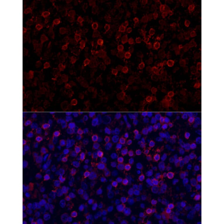 Immunofluorescence - Anti-PD1 Antibody (A87674) - Antibodies.com