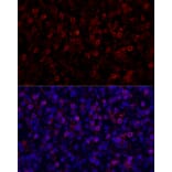Immunofluorescence - Anti-PD1 Antibody (A87674) - Antibodies.com