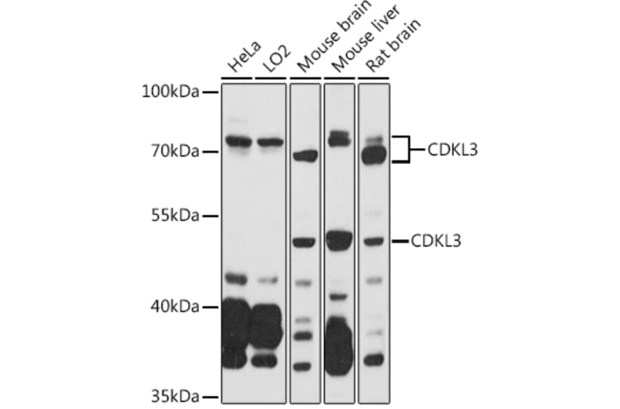 Western Blot - Anti-NKIAMRE Antibody (A87675) - Antibodies.com