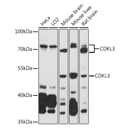 Western Blot - Anti-NKIAMRE Antibody (A87675) - Antibodies.com