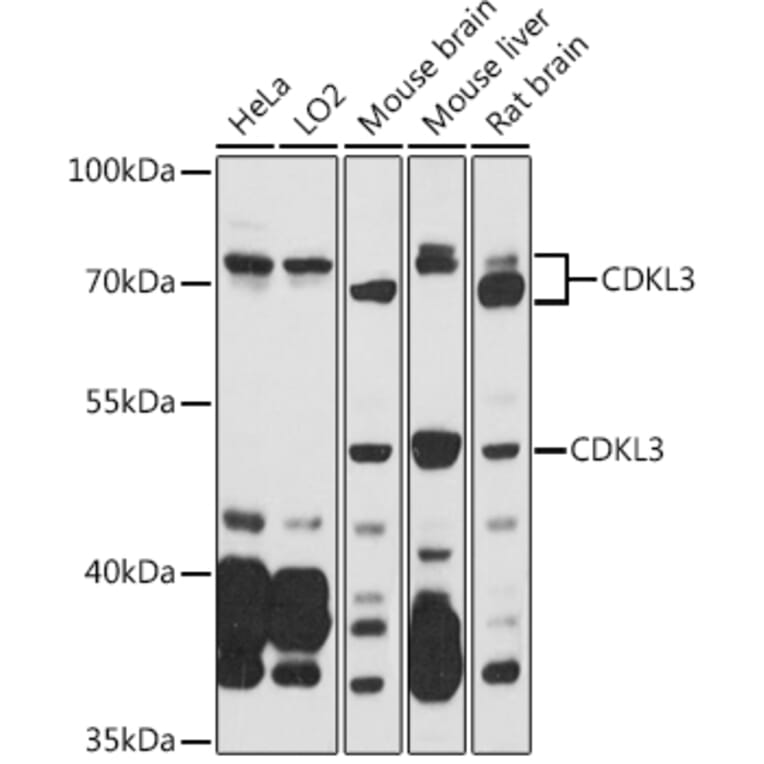 Western Blot - Anti-NKIAMRE Antibody (A87675) - Antibodies.com