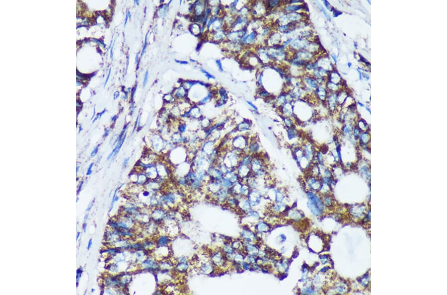 Immunohistochemistry - Anti-NKIAMRE Antibody (A87675) - Antibodies.com