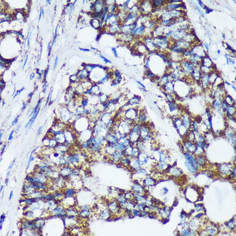 Immunohistochemistry - Anti-NKIAMRE Antibody (A87675) - Antibodies.com