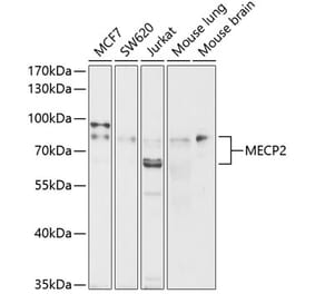 Western Blot - Anti-MeCP2 Antibody (A87676) - Antibodies.com