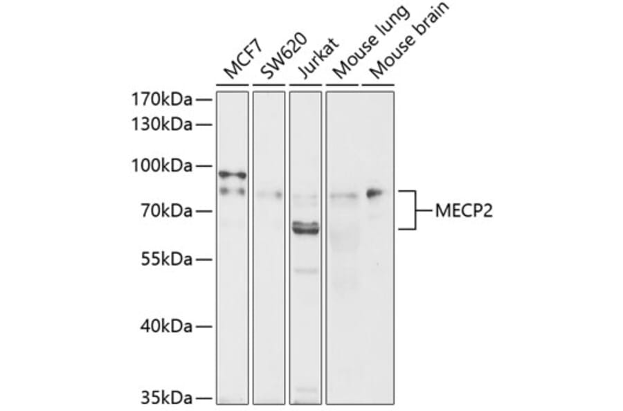 Western Blot - Anti-MeCP2 Antibody (A87676) - Antibodies.com