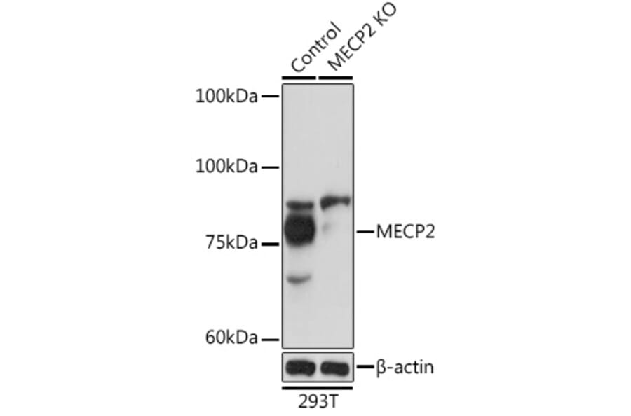 Western Blot - Anti-MeCP2 Antibody (A87676) - Antibodies.com