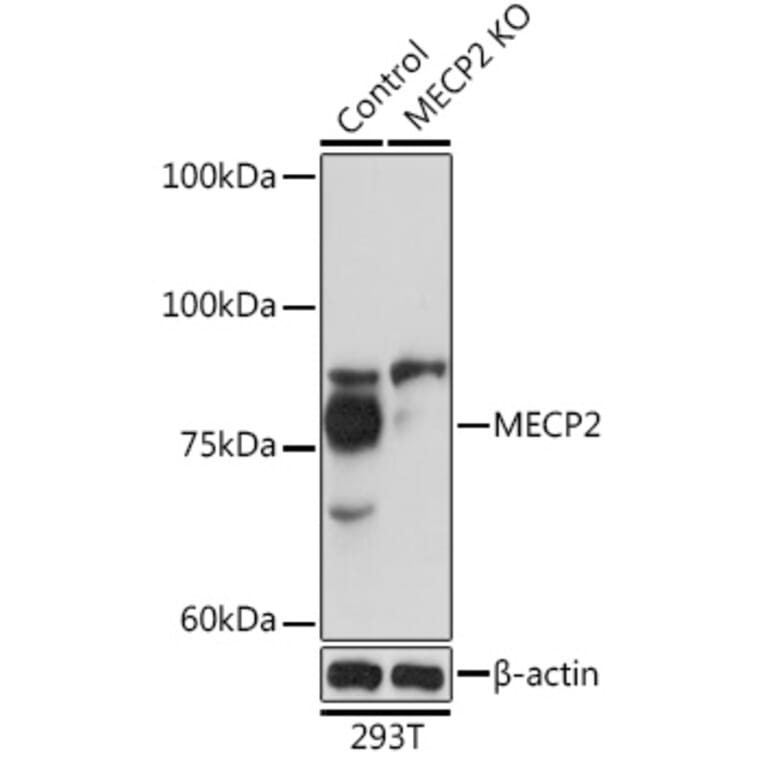 Western Blot - Anti-MeCP2 Antibody (A87676) - Antibodies.com