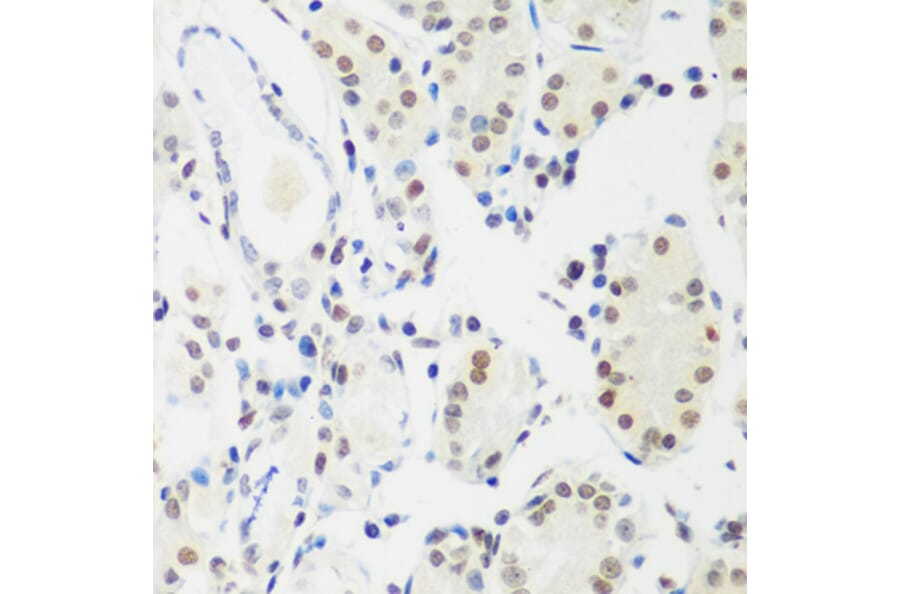 Immunohistochemistry - Anti-MeCP2 Antibody (A87676) - Antibodies.com
