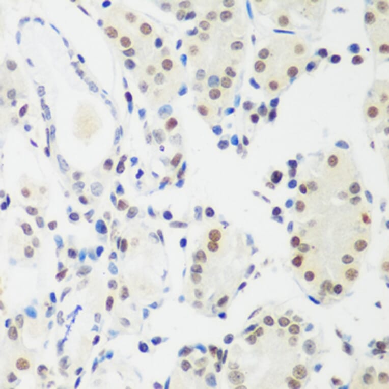 Immunohistochemistry - Anti-MeCP2 Antibody (A87676) - Antibodies.com