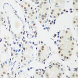 Immunohistochemistry - Anti-MeCP2 Antibody (A87676) - Antibodies.com