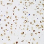 Immunohistochemistry - Anti-MeCP2 Antibody (A87676) - Antibodies.com