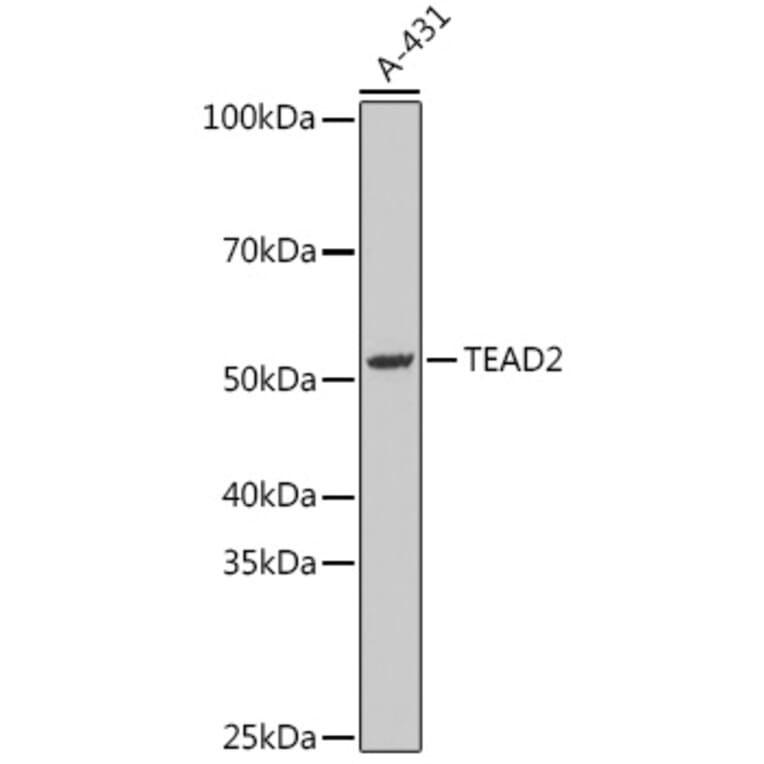Western Blot - Anti-TEA domain family member 2 / ETF Antibody (A87677) - Antibodies.com