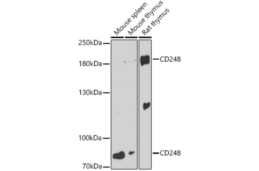 Western Blot - Anti-TEM1 Antibody (A87678) - Antibodies.com