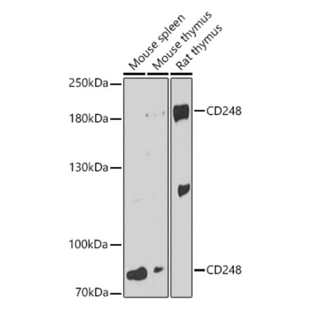 Western Blot - Anti-TEM1 Antibody (A87678) - Antibodies.com