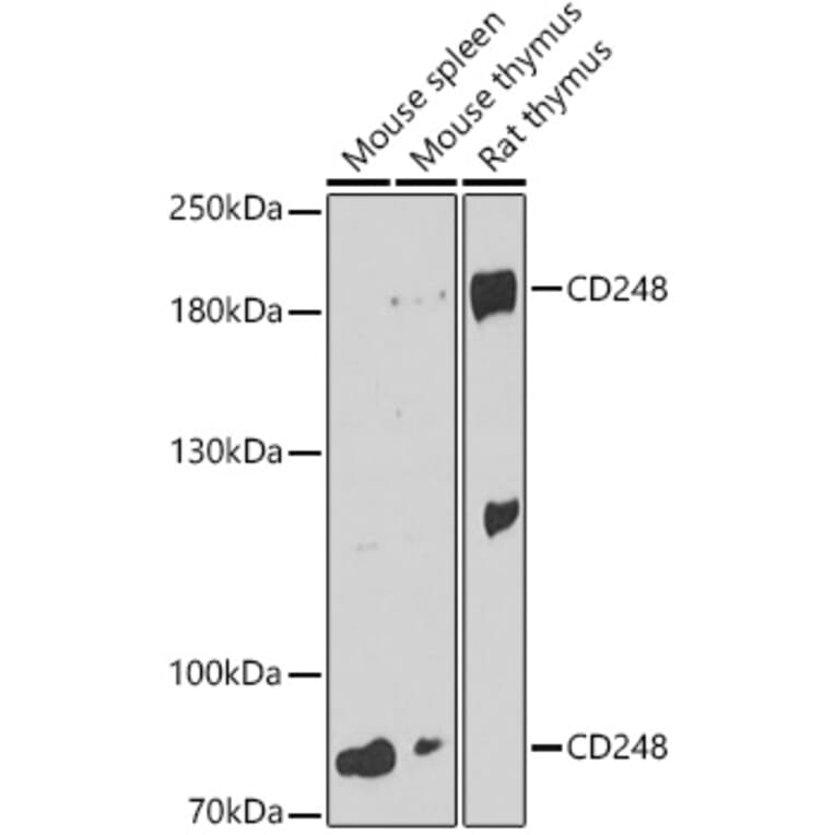 Western Blot - Anti-TEM1 Antibody (A87678) - Antibodies.com