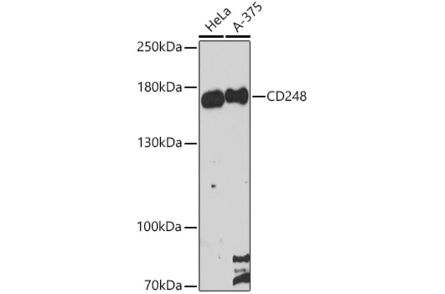 Western Blot - Anti-TEM1 Antibody (A87678) - Antibodies.com