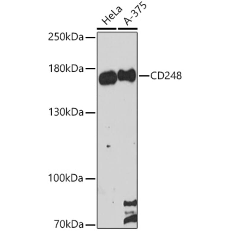 Western Blot - Anti-TEM1 Antibody (A87678) - Antibodies.com