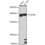 Western Blot - Anti-TEM1 Antibody (A87678) - Antibodies.com