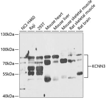 Western blot analysis of extracts of various cell lines, using Anti-KCNN3 Antibody (A14012) at 1:1,000 dilution.
Secondary antibody: Goat Anti-Rabbit IgG (H+L) (HRP) (AS014) at 1:10,000 dilution.
Lysates / proteins: 25µg per lane.
Blocking buffer: 3% non-fat dry milk in TBST.
Detection: ECL Enhanced Kit (RM00021).
Exposure time: 60s.