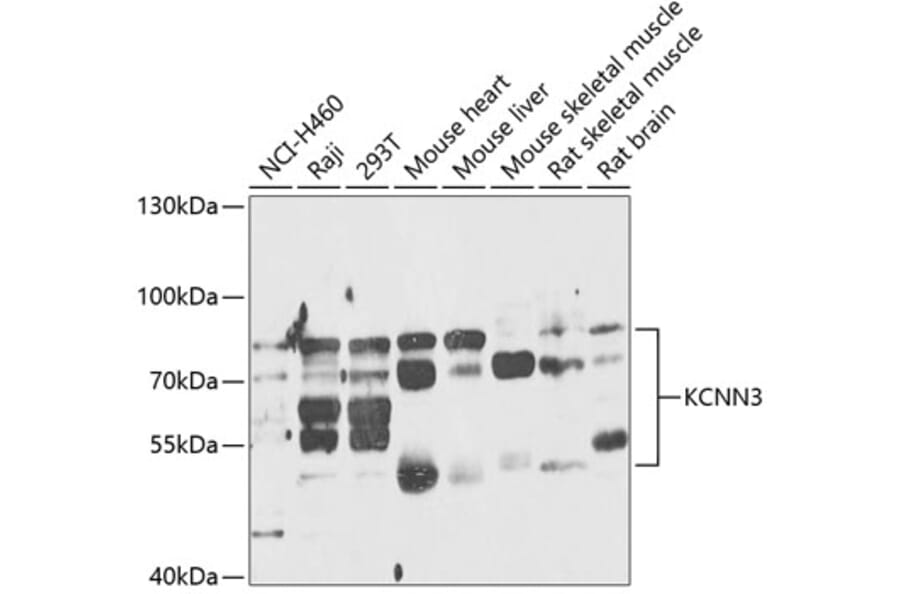 Western Blot - Anti-KCNN3/SK3 Antibody (A87679) - Antibodies.com