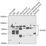 Western Blot - Anti-KCNN3/SK3 Antibody (A87679) - Antibodies.com