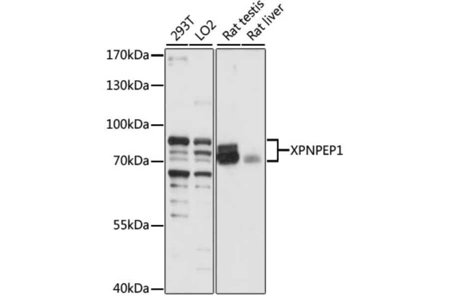 Western Blot - Anti-XPNPEP1 Antibody (A87680) - Antibodies.com