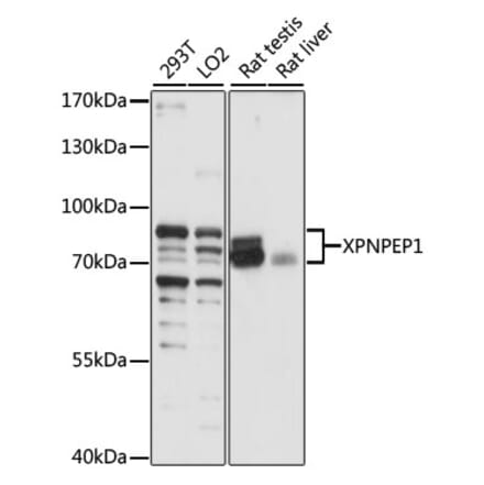 Western Blot - Anti-XPNPEP1 Antibody (A87680) - Antibodies.com