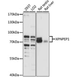 Western Blot - Anti-XPNPEP1 Antibody (A87680) - Antibodies.com