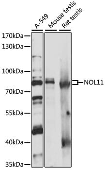 Western blot analysis of extracts of various cell lines, using Anti-NOL11 Antibody (A15419) at 1:1,000 dilution.
Secondary antibody: Goat Anti-Rabbit IgG (H+L) (HRP) (AS014) at 1:10,000 dilution.
Lysates / proteins: 25µg per lane.
Blocking buffer: 3% non-fat dry milk in TBST.
Detection: ECL Enhanced Kit (RM00021).
Exposure time: 1s.