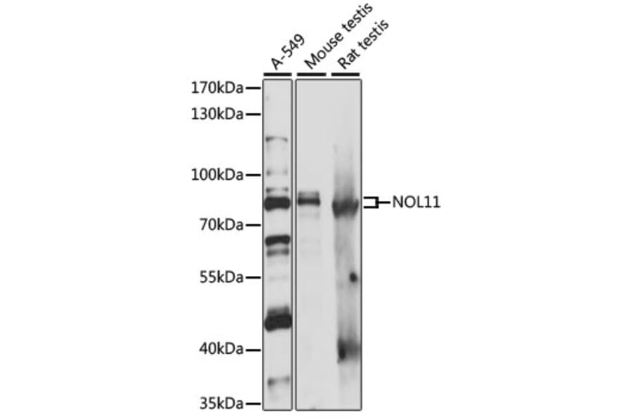 Western Blot - Anti-NOL11 Antibody (A87681) - Antibodies.com