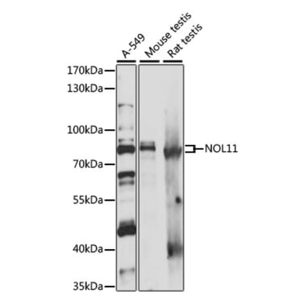Western Blot - Anti-NOL11 Antibody (A87681) - Antibodies.com