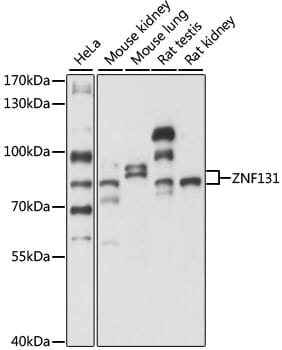 Western blot analysis of extracts of various cell lines, using Anti-ZNF131 Antibody (A15331) at 1:1,000 dilution.
Secondary antibody: Goat Anti-Rabbit IgG (H+L) (HRP) (AS014) at 1:10,000 dilution.
Lysates / proteins: 25µg per lane.
Blocking buffer: 3% non-fat dry milk in TBST.
Detection: ECL Basic Kit (RM00020).
Exposure time: 5s.