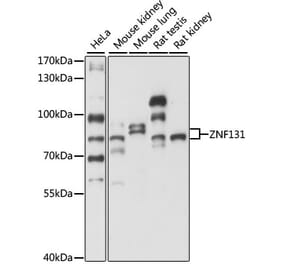 Western Blot - Anti-ZNF131 Antibody (A87682) - Antibodies.com