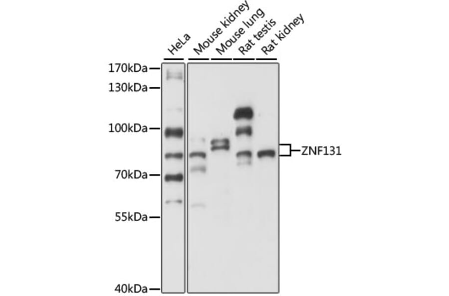 Western Blot - Anti-ZNF131 Antibody (A87682) - Antibodies.com