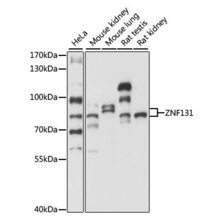 Western Blot - Anti-ZNF131 Antibody (A87682) - Antibodies.com