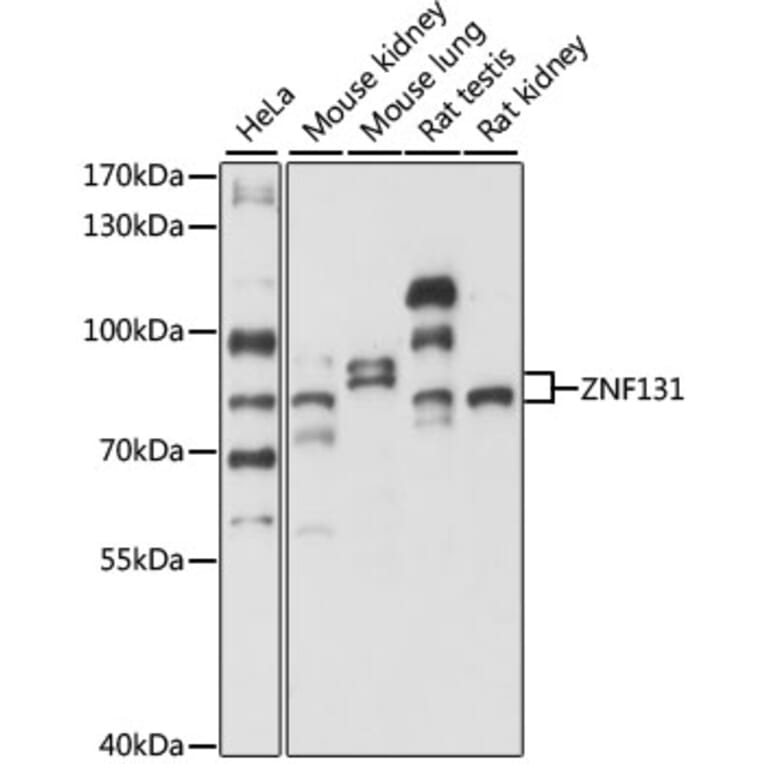 Western Blot - Anti-ZNF131 Antibody (A87682) - Antibodies.com