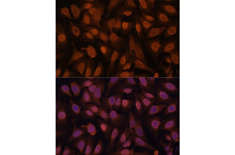 Immunofluorescence - Anti-ZNF131 Antibody (A87682) - Antibodies.com