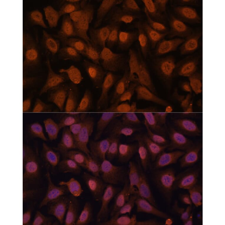 Immunofluorescence - Anti-ZNF131 Antibody (A87682) - Antibodies.com