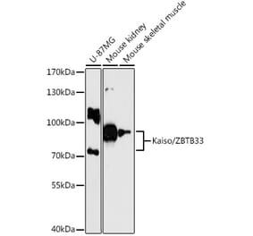 Western Blot - Anti-KAISO Antibody (A87683) - Antibodies.com