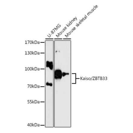 Western Blot - Anti-KAISO Antibody (A87683) - Antibodies.com